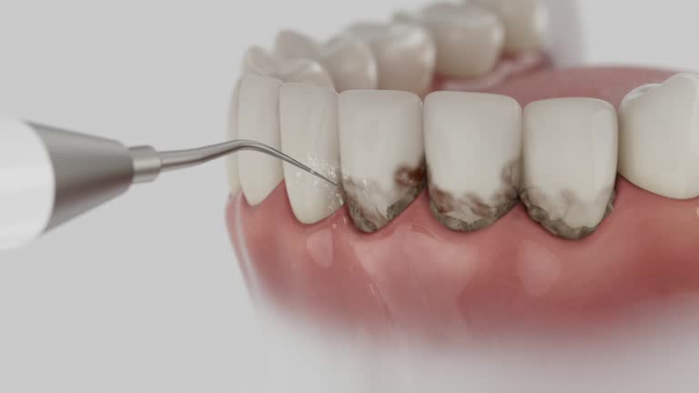 Trusted Tooth Extraction service in Canby, MN - Dentist Open Now